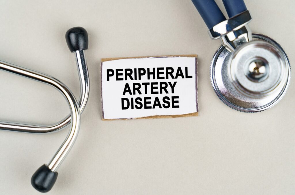 Peripheral Arterial Disease (PAD): What You Need to Know About Symptoms and Treatment