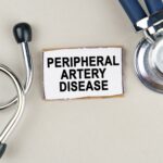 Peripheral Arterial Disease