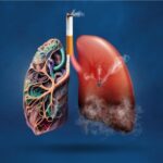 vascular surgeon in Houston