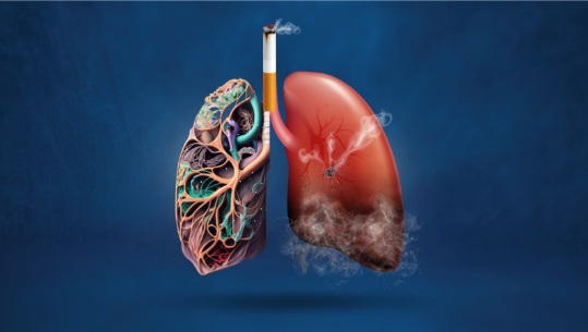 How Smoking Affects Your Vascular Health? Discover the Risks of AAA, PAD, and Stroke